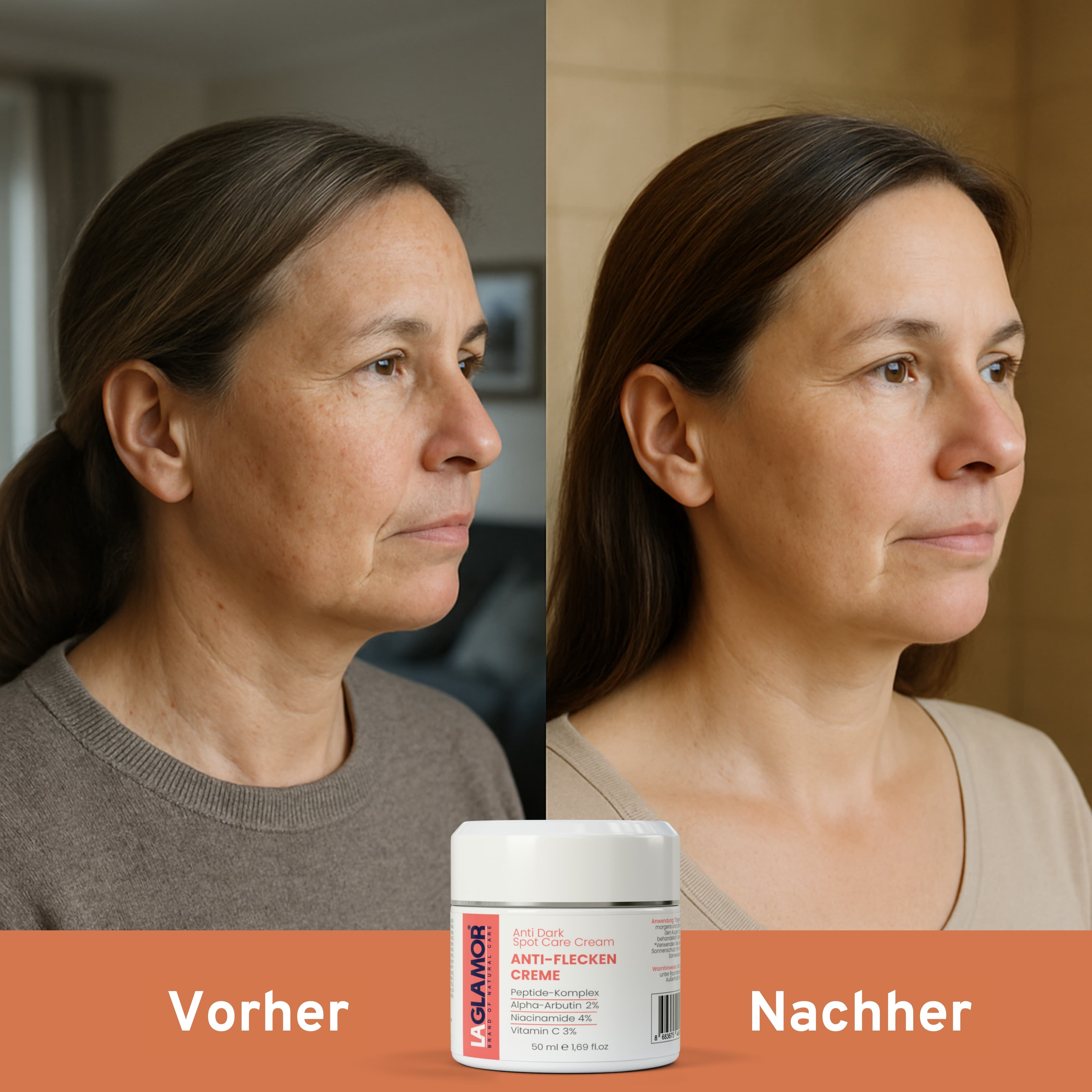 Anti-Flecken Creme - 50ml