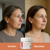 Anti-Flecken Creme - 50ml